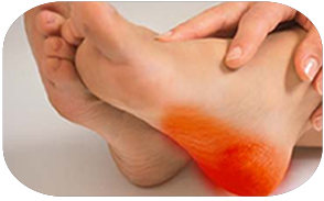 Heel pain